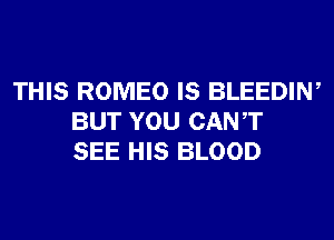 THIS ROMEO IS BLEEDIW
BUT YOU CANT
SEE HIS BLOOD