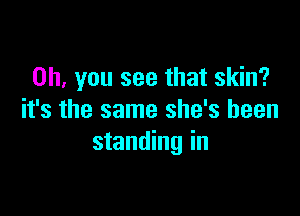 Oh, you see that skin?

it's the same she's been
standing in